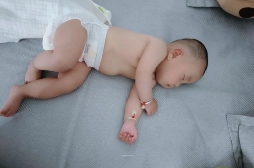 五家渠宝宝褶皱处擦粉还是油